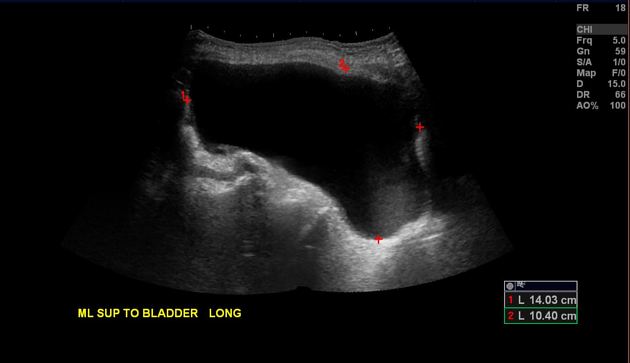 Radiology Ultrasound