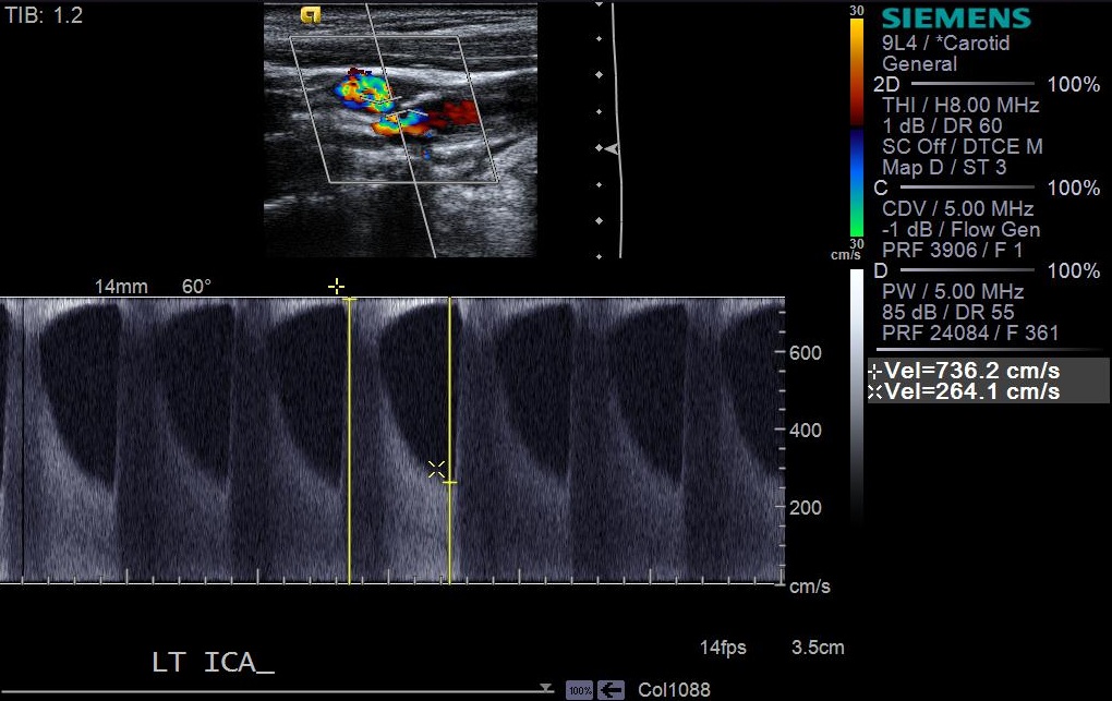 Image | Radiopaedia.org