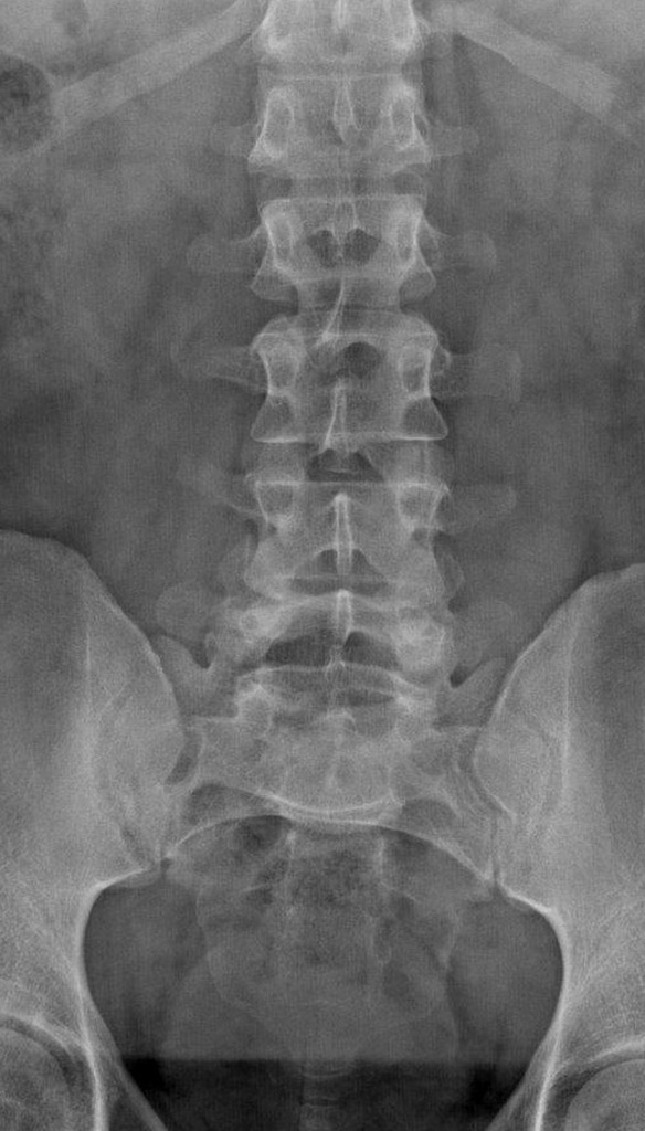 Radiology Quiz 464 Radiopaedia Orgviewing Playlist Radiographie Normal Radiopaedia Org