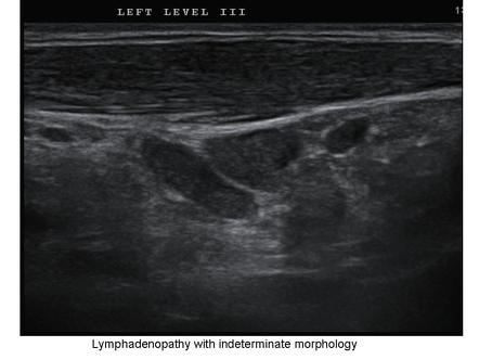 Viewing playlist: Thyroid Ultrasound | Radiopaedia.org