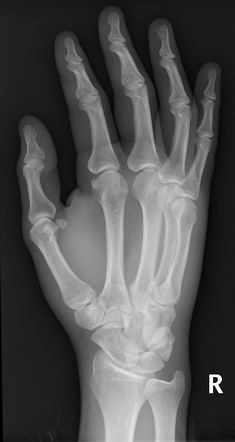 Radiology Quiz 46658 | Radiopaedia.org