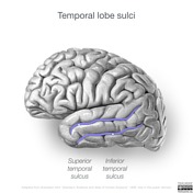 Temporal lobe | Radiology Reference Article | Radiopaedia.org