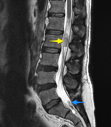 Image | Radiopaedia.org