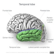 temporoparietal vs temporal