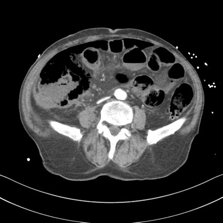 Viewing playlist: KC Set 2 FRCR 2B Viva | Radiopaedia.org