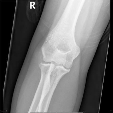 Viewing playlist: Clinical Student Cases | Radiopaedia.org