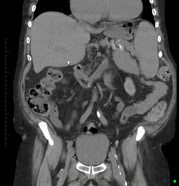 Radiology Quiz Radiopaedia Orgviewing Playlist Nieren Radiopaedia Org