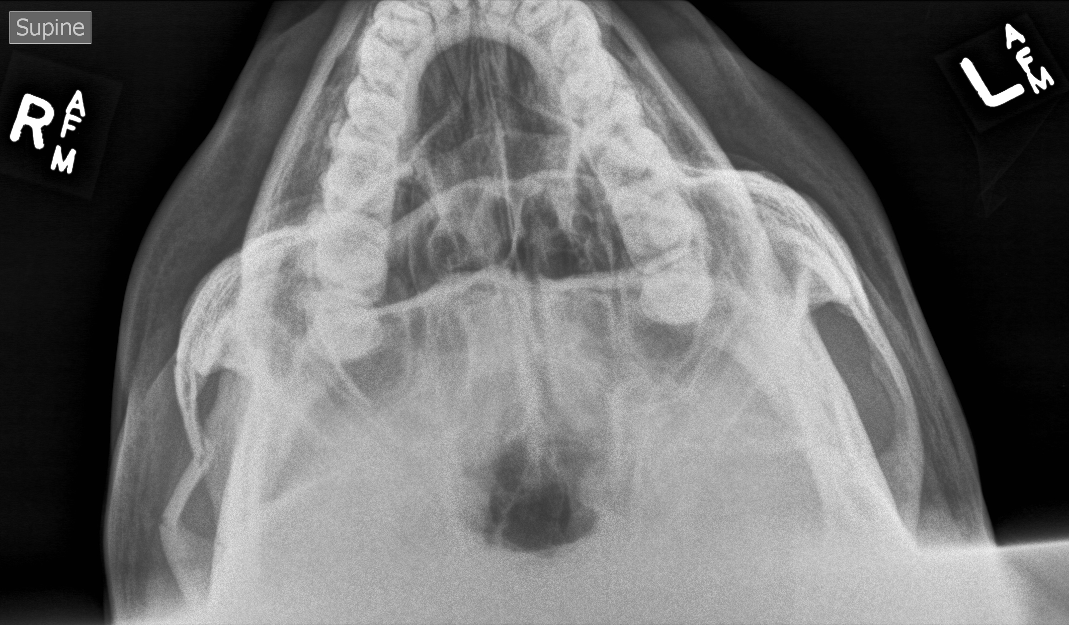 Zygomatic Arkadium