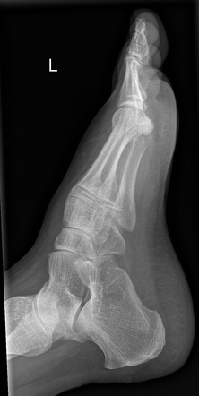 Lower Limb Radiography 