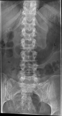 Viewing playlist: CHR 663L Lesson 9: Abdominal Imaging | Radiopaedia.org