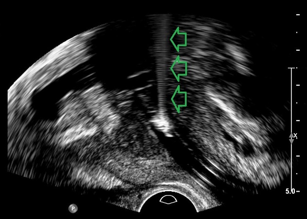  Ultrasound Physics Scanning AND Modes M Mode  Dde9f79fbb8a574b990f39a8894467_big_gallery