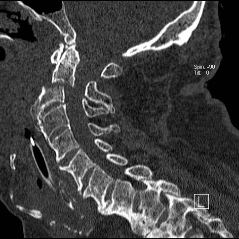 The Skeletal System Embryology Pathology Fracture