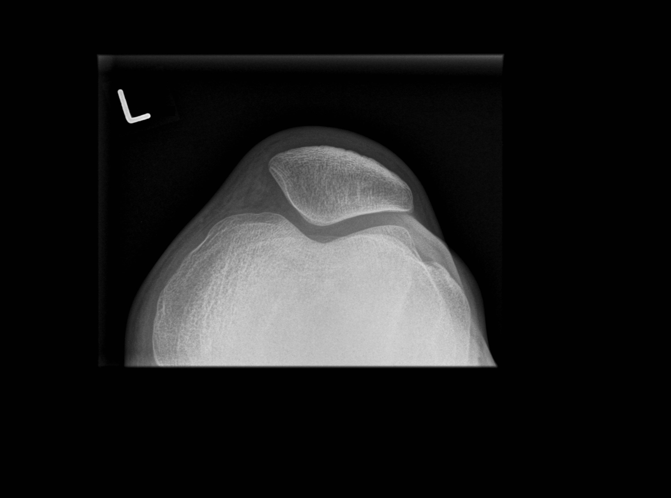 Normal Knee Image