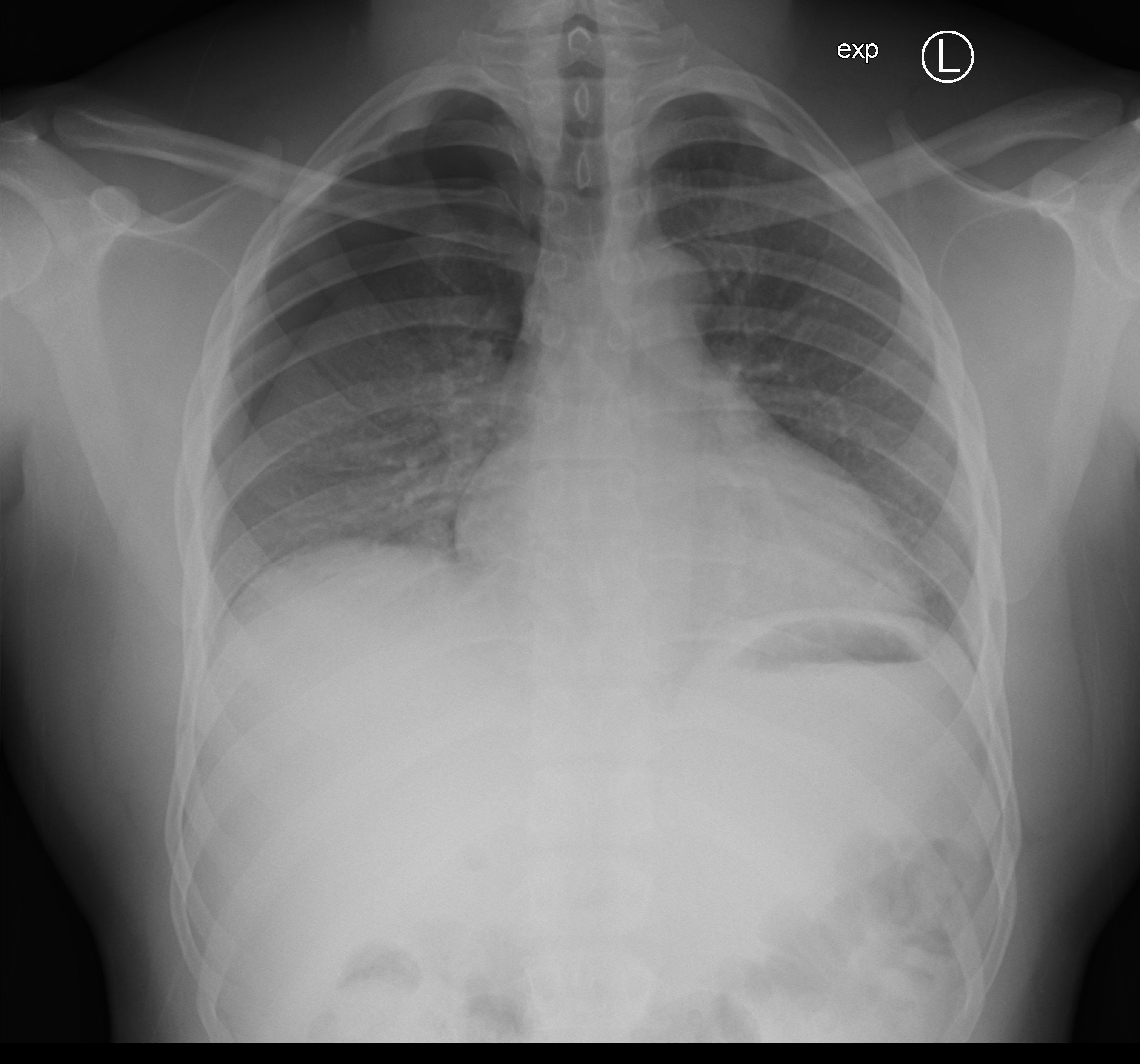 Sticky tape takes X-ray images – Physics World