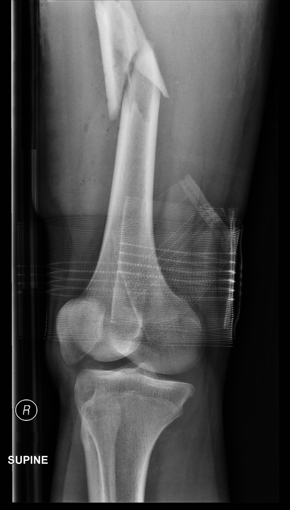 Radiology Quiz 48399 | Radiopaedia.org