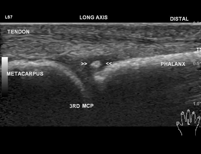 Image | Radiopaedia.org