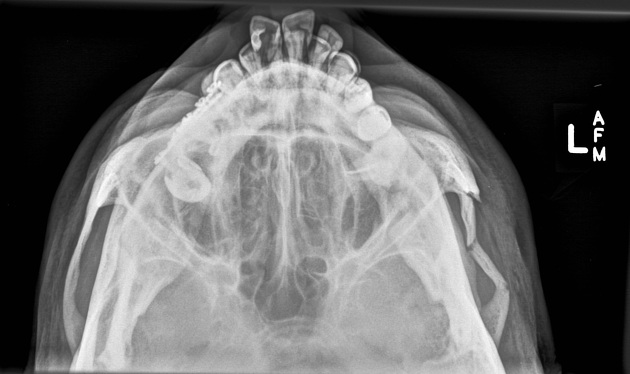 Submentovertical Zygomatic Arches