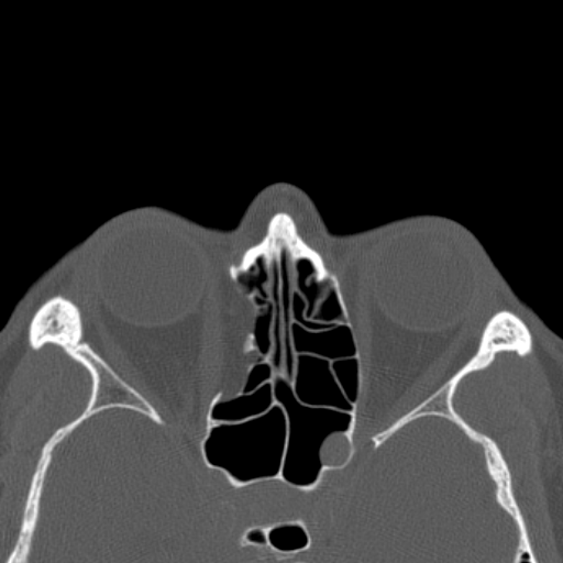 Image | Radiopaedia.org