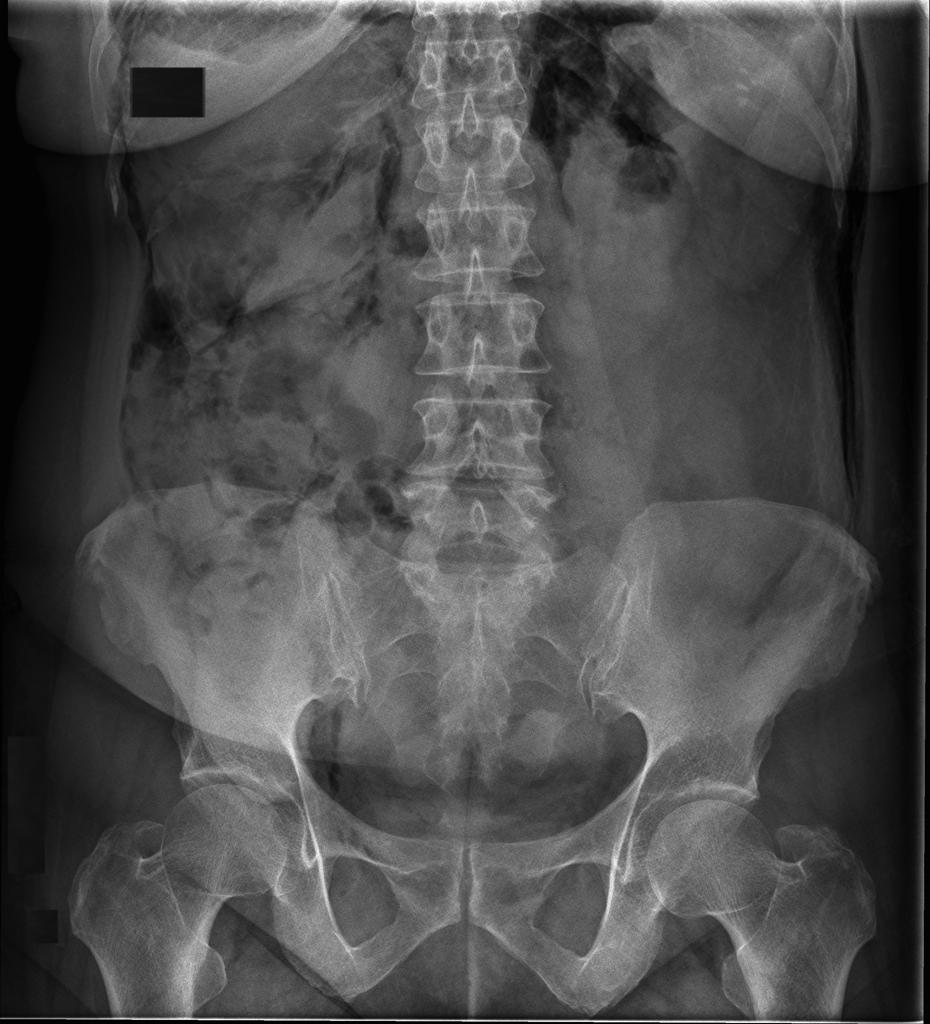 Sticky tape takes X-ray images – Physics World