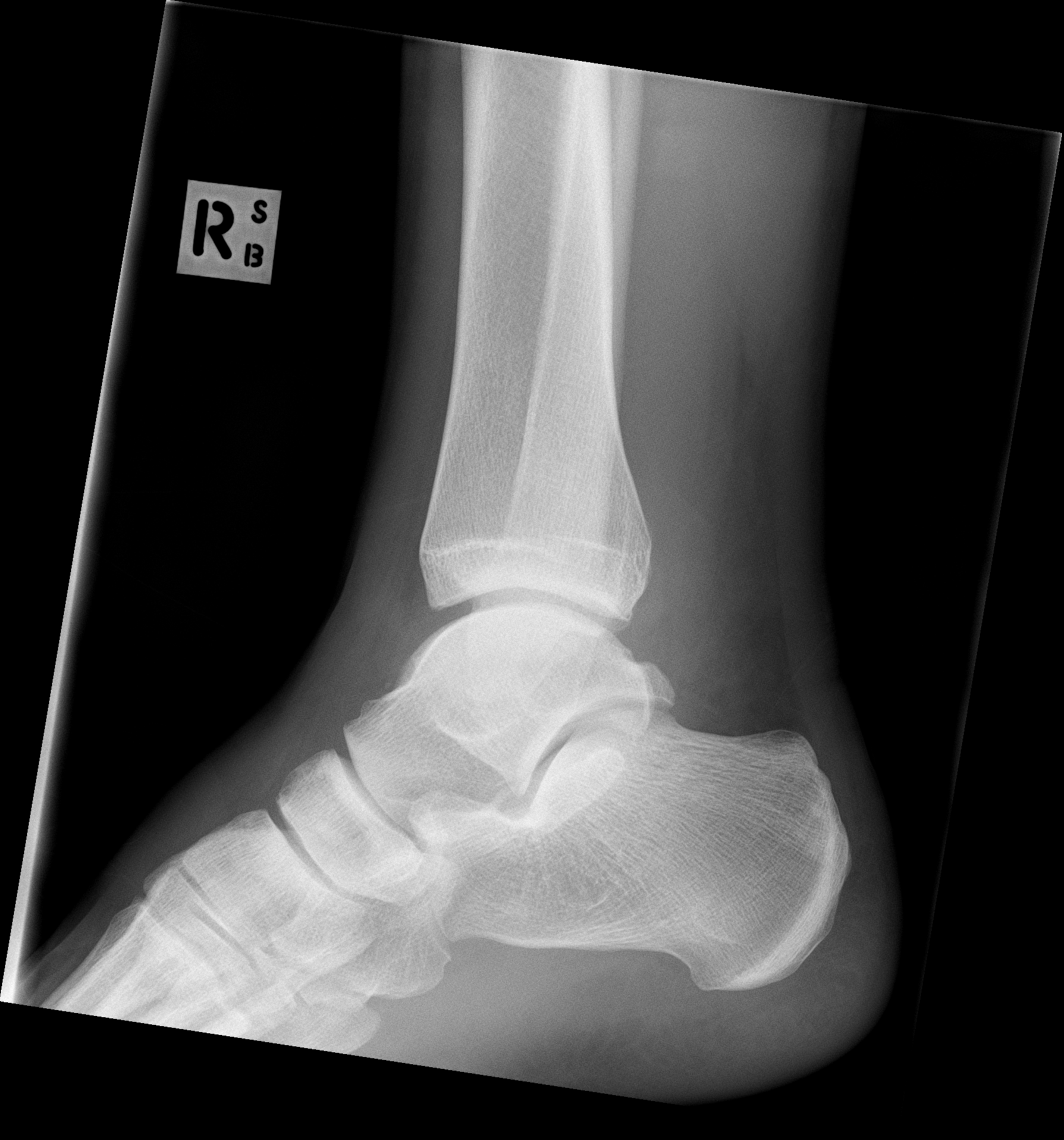 Lateral Ankle X Ray Anatomy