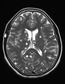 Radiology Quiz 20535 | Radiopaedia.org | Playlist 'efilm2011(1)' by 