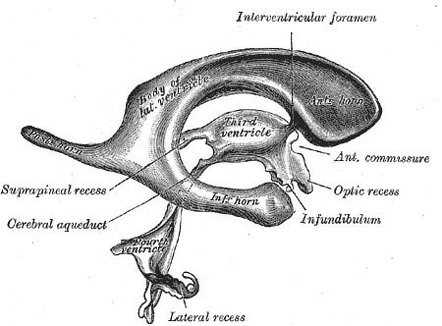 Pineal recess | Radiology Reference Article | Radiopaedia.org