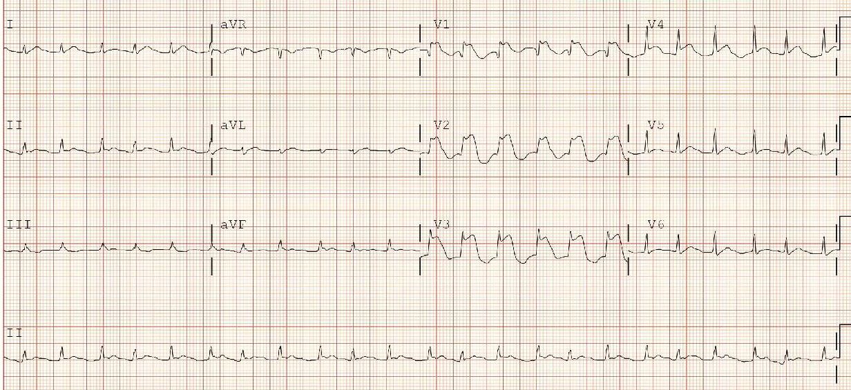 Image | Radiopaedia.org