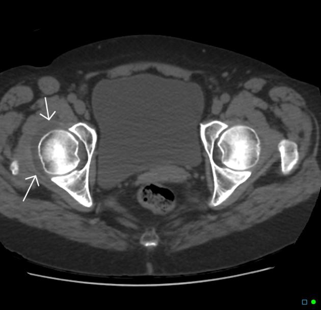 Normal Hip Image Data – Musculoskeletal Research, 58% OFF