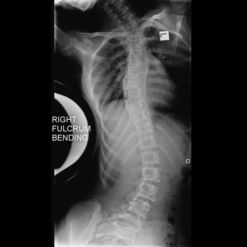 Sticky tape takes X-ray images – Physics World