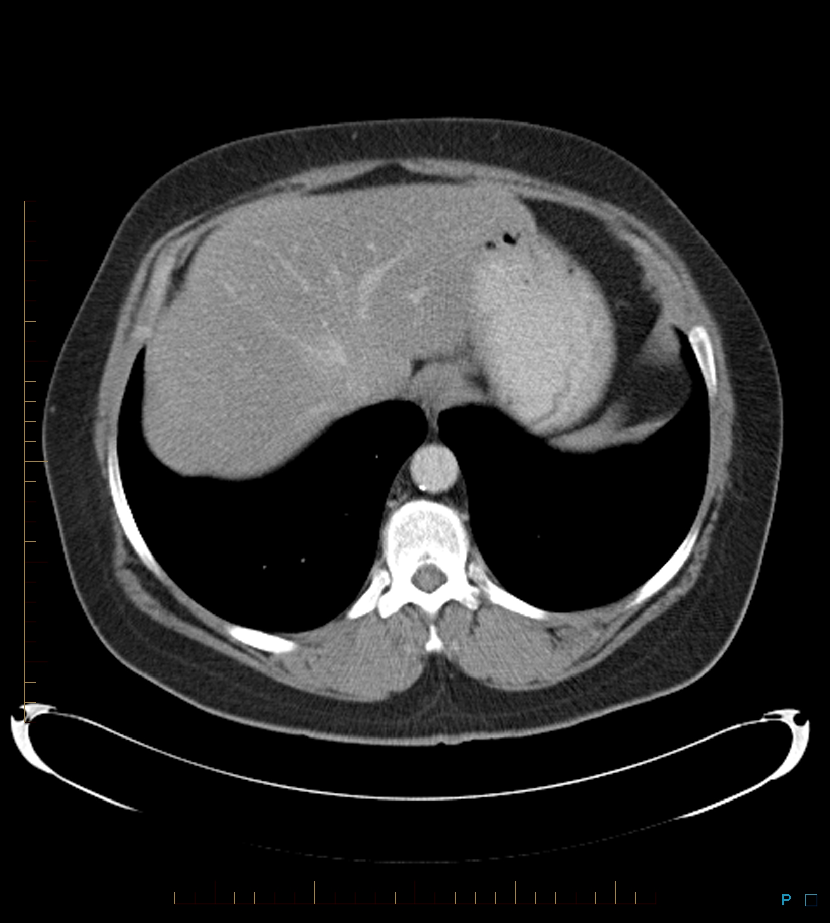 Radiology Quiz 49798 | Radiopaedia.org