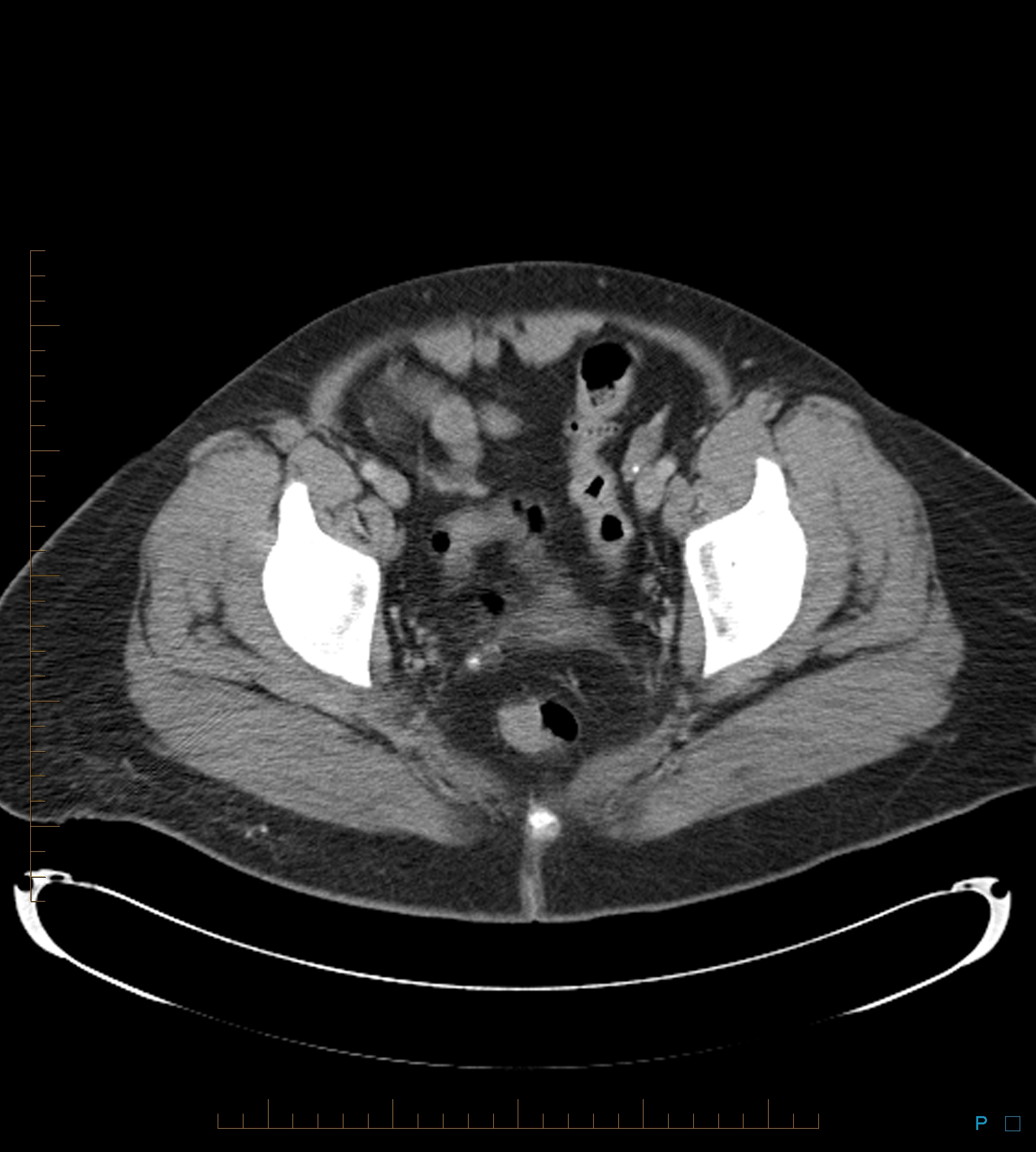 Radiology Quiz 49798 | Radiopaedia.org