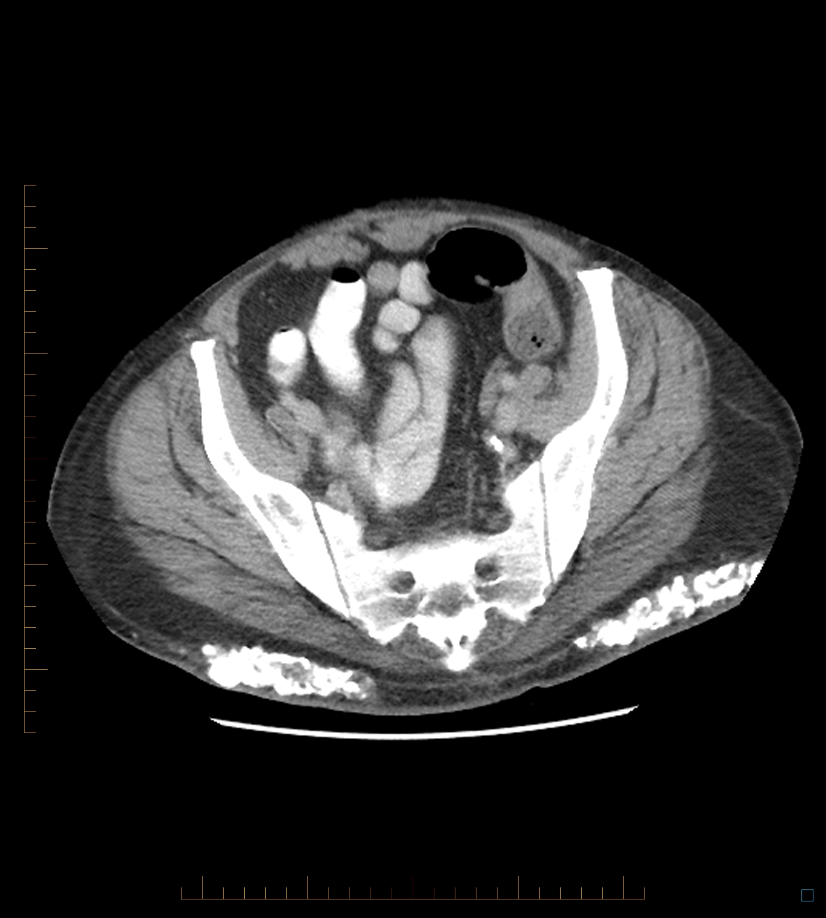 Radiology Quiz 49798 | Radiopaedia.org