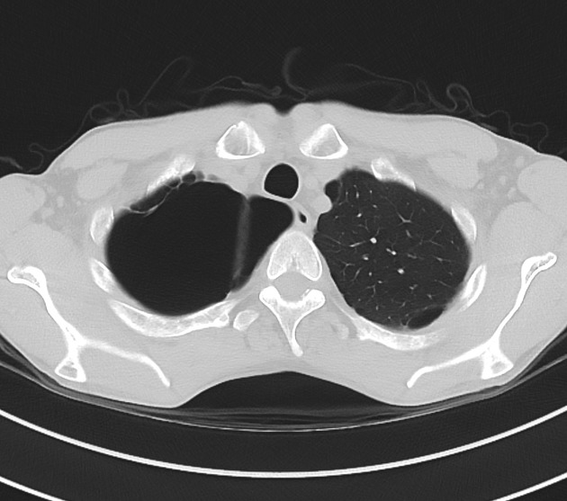 Images | Radiopaedia.org