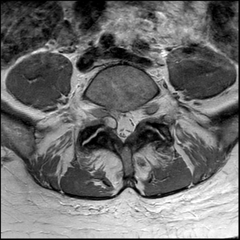 Image Radiopaedia Org