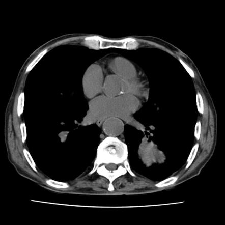 Viewing playlist: Cases RF | Radiopaedia.org