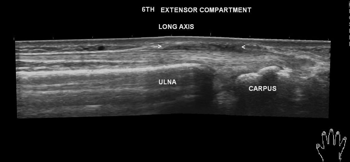 Image | Radiopaedia.org