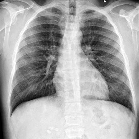 Viewing playlist: Hard to see cases | Radiopaedia.org