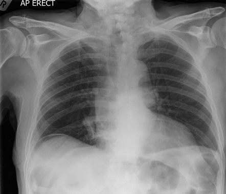 Viewing playlist: Interesting Cases | Radiopaedia.org