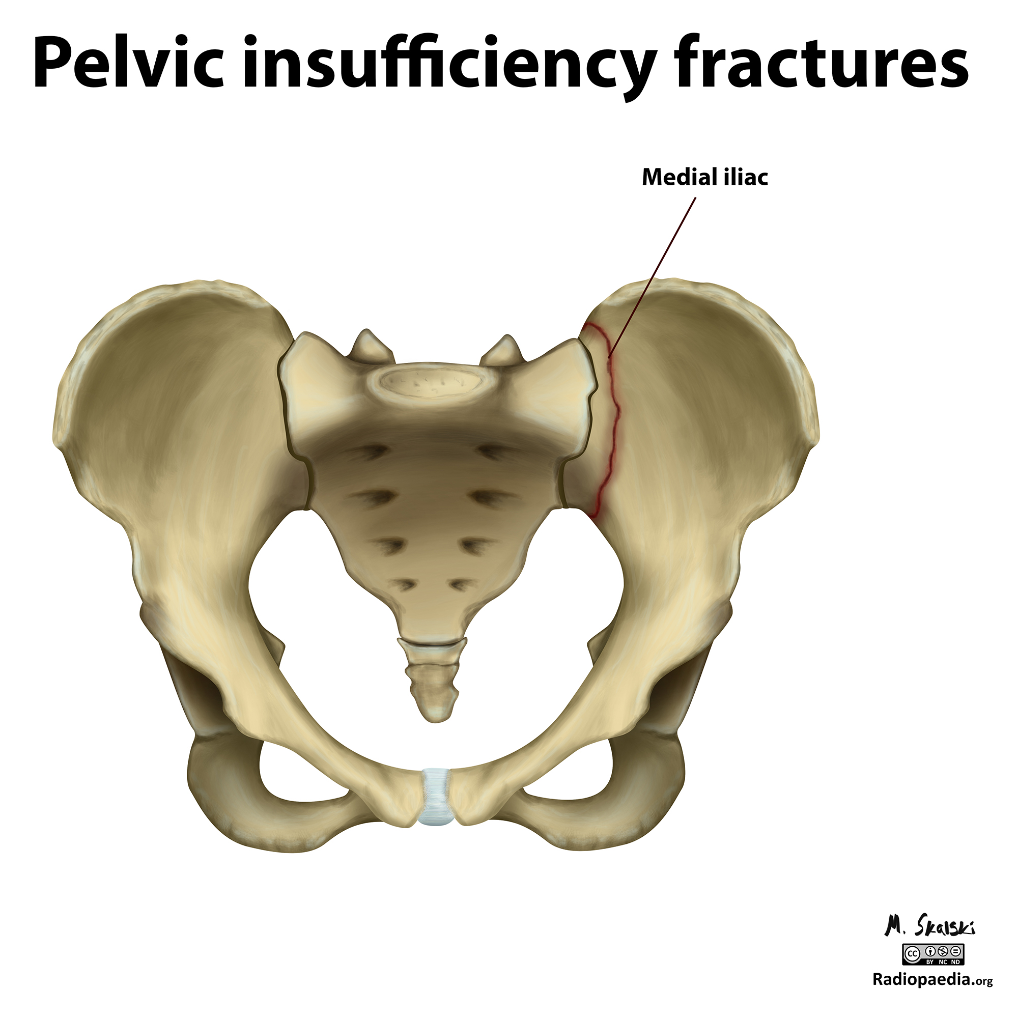 Image | Radiopaedia.org