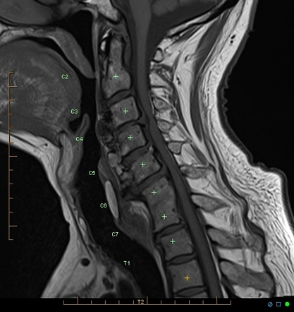 Image | Radiopaedia.org