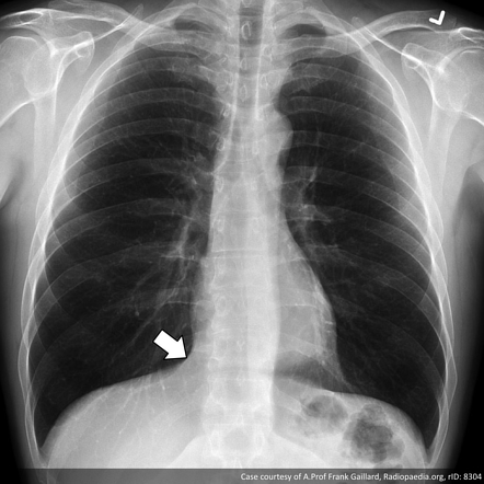 Images for MCQs | Radiology Case | Radiopaedia.org