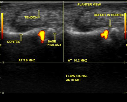 Image | Radiopaedia.org