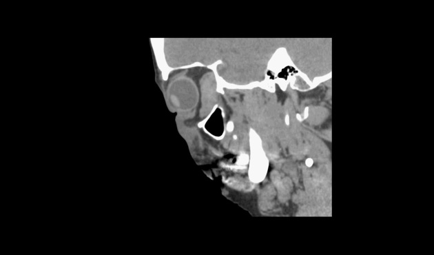 Images | Radiopaedia.org