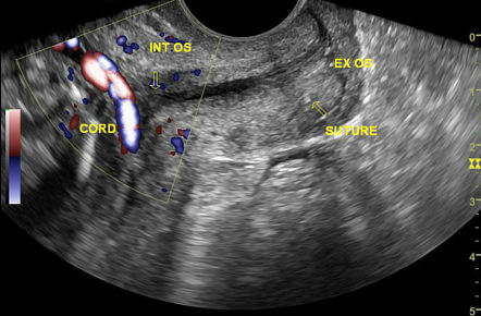 Playlist 'Ob/gyn cases' by Ngan Thang