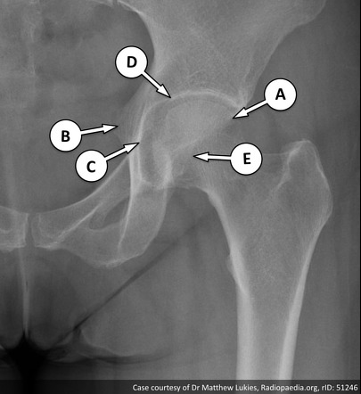 Image | Radiopaedia.org