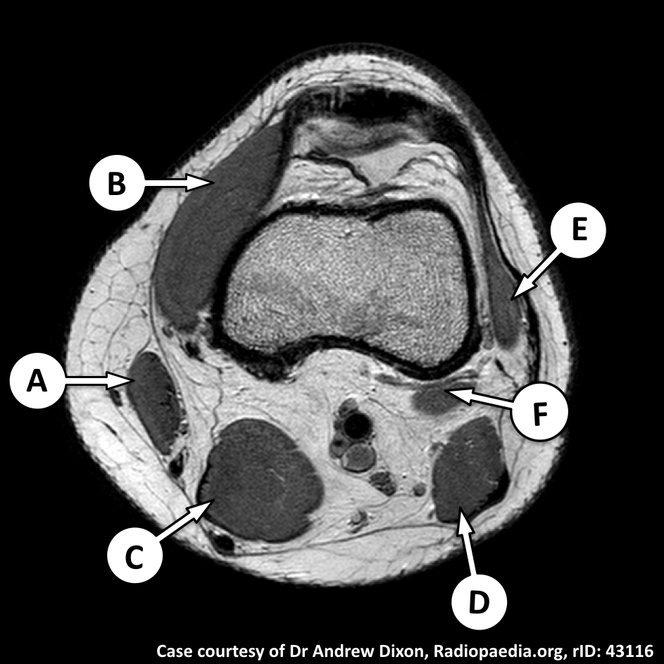 Image | Radiopaedia.org