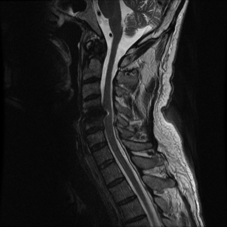 Viewing playlist: SPINE | Radiopaedia.org