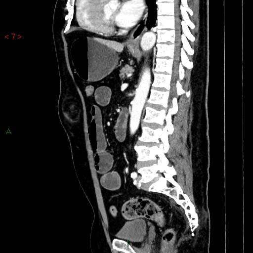 Image | Radiopaedia.org