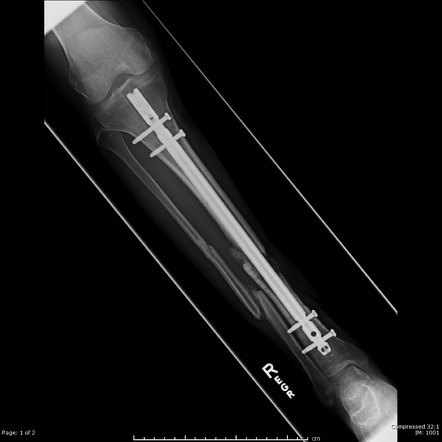 Radiology Quiz 51601 | Radiopaedia.org