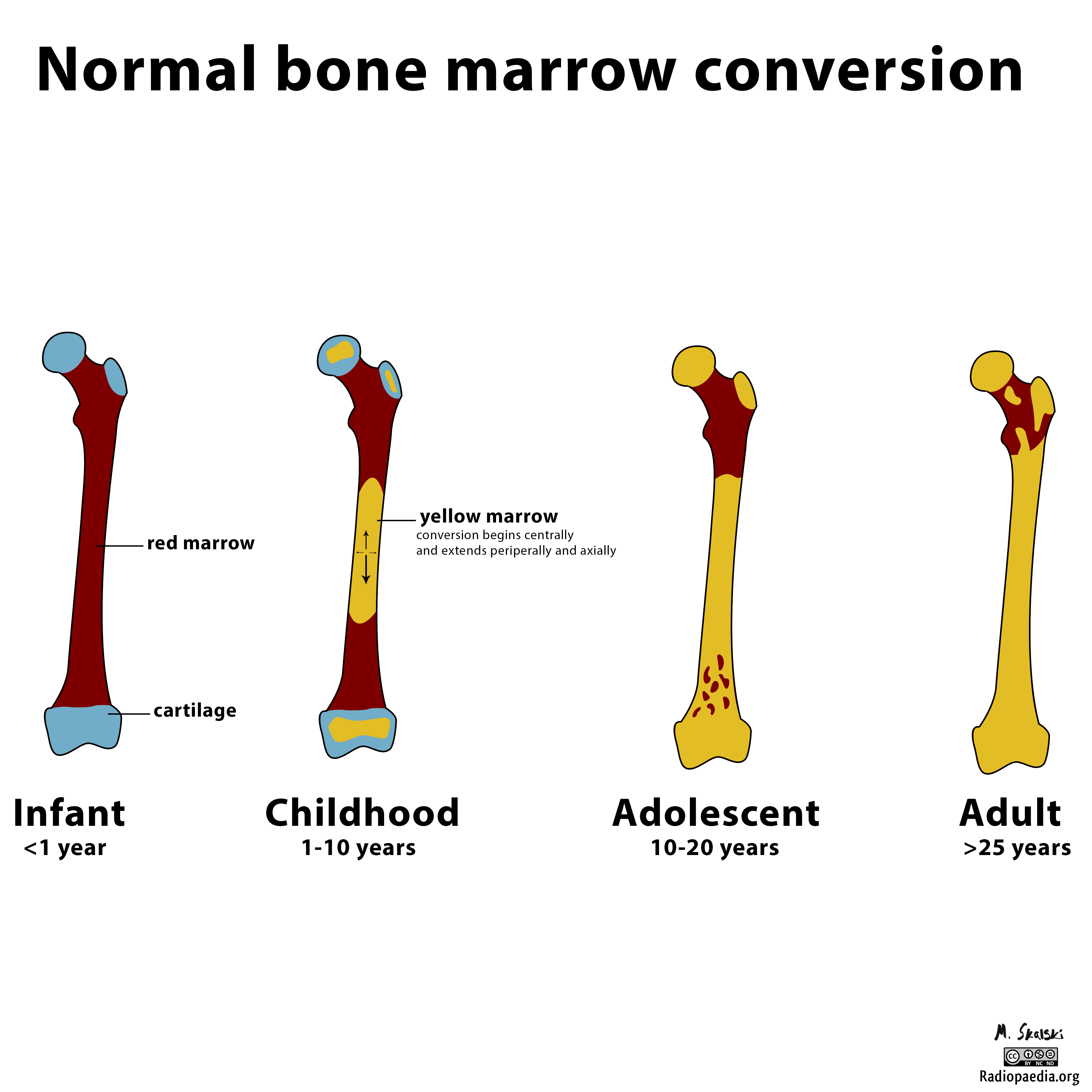 Bone marrow. Red Bone marrow. Yellow Bone marrow. Red and Yellow Bone marrow. Bone marrow Anatomy.